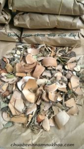 đau đầu đau đầu