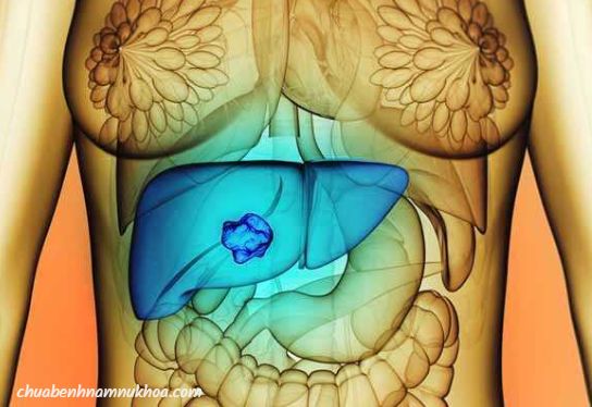ung thư gan  ung thư gan