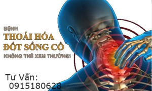 thoái hóa đốt sống cổ thoái hóa đốt sống cổ
