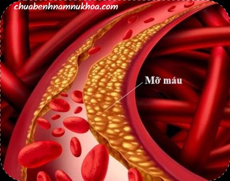 mỡ máu mỡ máu