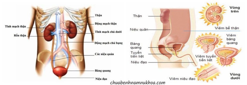 viêm tiết niệu viêm tiết niệu