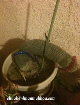 suy sinh dục suy sinh dục