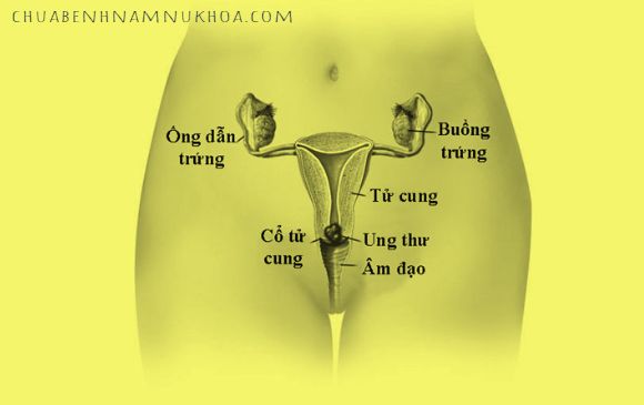 ung thư cổ tử cung ung thư cổ tử cung