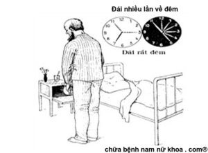 triệu chứng của phì đại tiền liệt tuyến