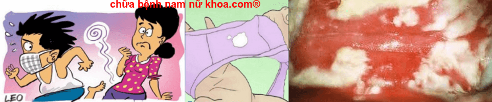 bạch đới Bạch đới