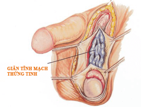 giãn thừng tinh giãn thừng tinh