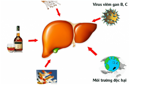 tác nhân gây ung thư gan
